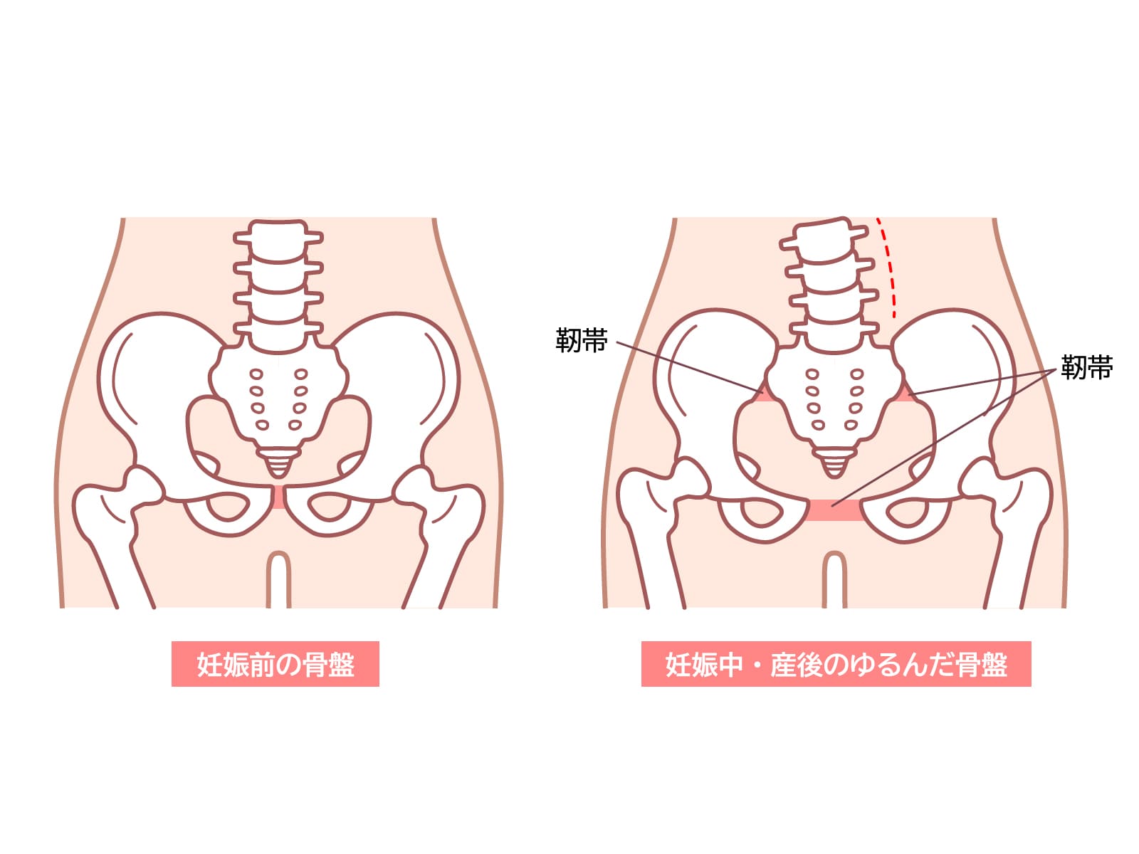 産後整体と骨盤ケアのイラスト